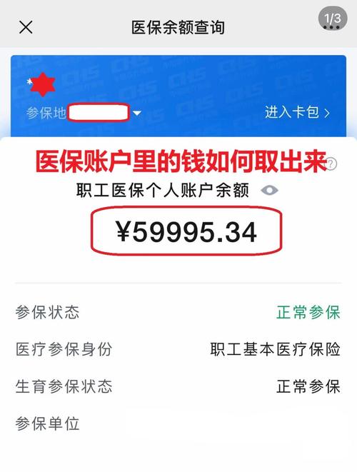 和泽医保在线提取新政策解读：你的医保余额真的能随时变现吗？